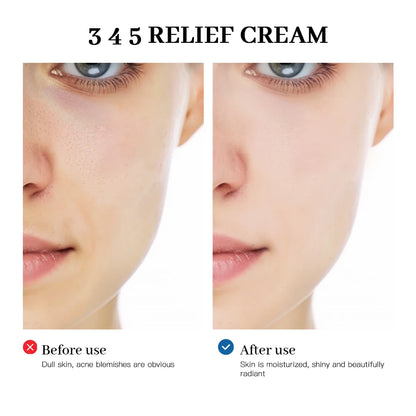 345 Relief Cream Comprehensive Solution to Skin Problems Anti-Sugar and Antioxidant Brightening Skin Improving Acne Marks Moistu